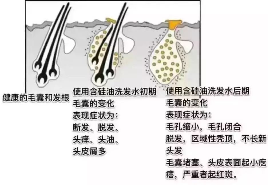 比较好用的德国防脱发,德国十大最好用的护肤品