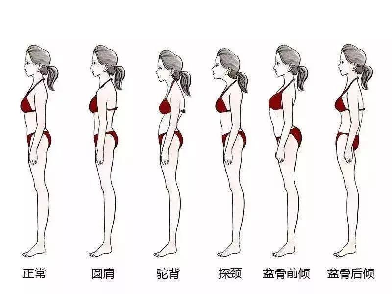 猥琐颈是什么,猥琐颈怎么矫正