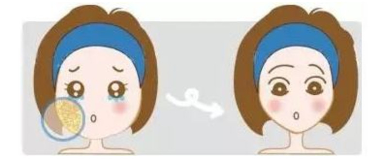 轮廓针和溶脂有什么区别,轮廓针和溶脂针哪个瘦脸效果好