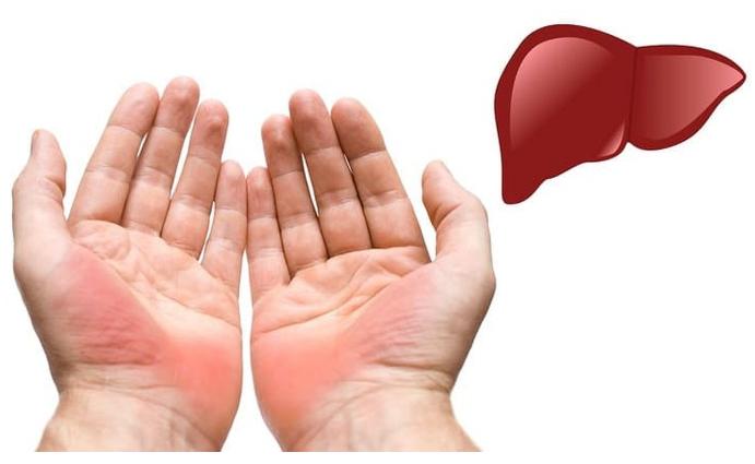 肝不好出现2痒3黑,肝不好的人会出现一痒二痛三黄