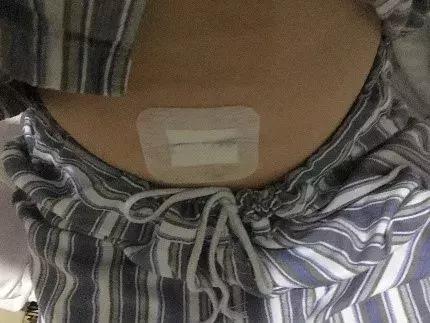 98’病人手术流水账：记录着崩溃、羞涩和坚强