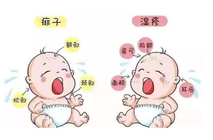 痱子和湿疹是怎么区别的,对痱子和湿疹的预防和护理
