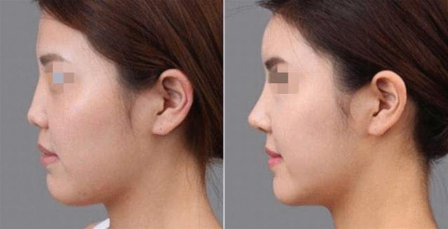 整容最成功的美人,整容最成功的13个人