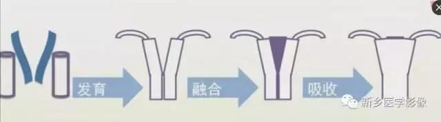 子宫发育异常,应想到的6大类常见畸形