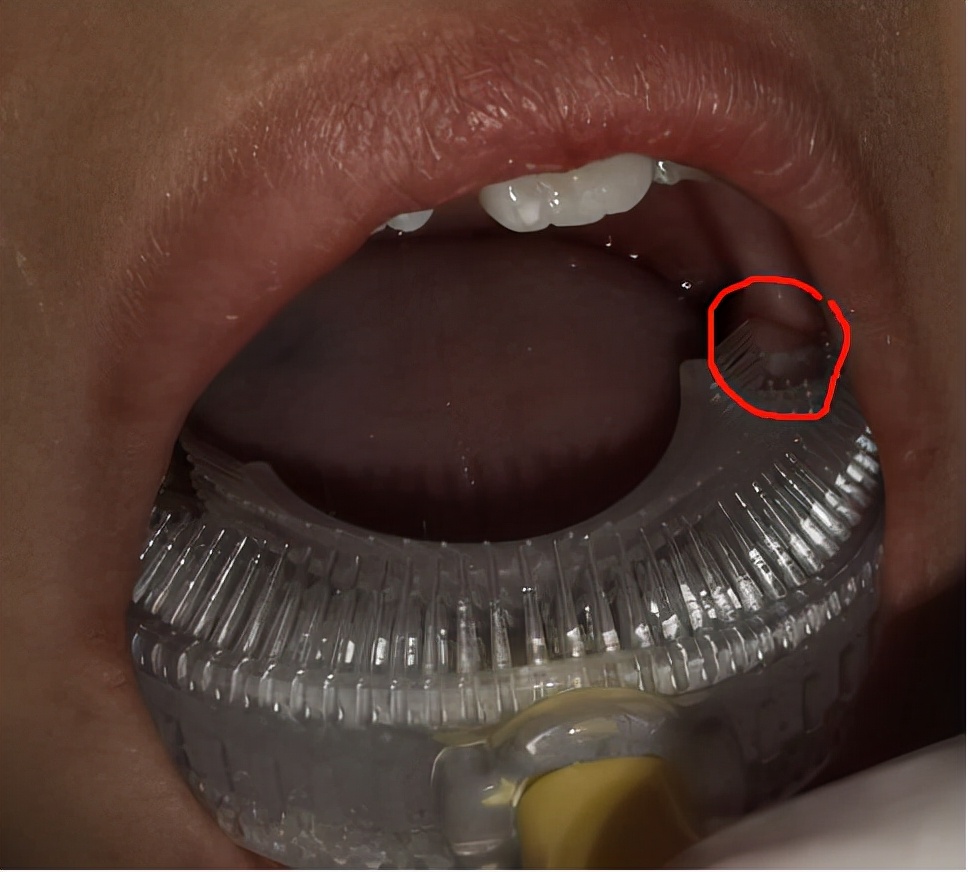 u型牙刷是不是要用专用牙膏,儿童牙刷u型口含全自动2-12岁用法