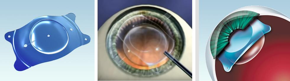 近视这么多为啥近视行业不好做,行业近视症会导致企业迅速衰败吗