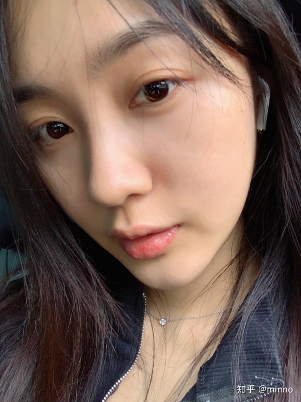 痘印泛红黑眼圈,改善斑点痘印暗黄的问题