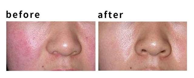 寡肽抗皱精华液对祛皱效果好吗,肽寡肽胜肽多肽的区分