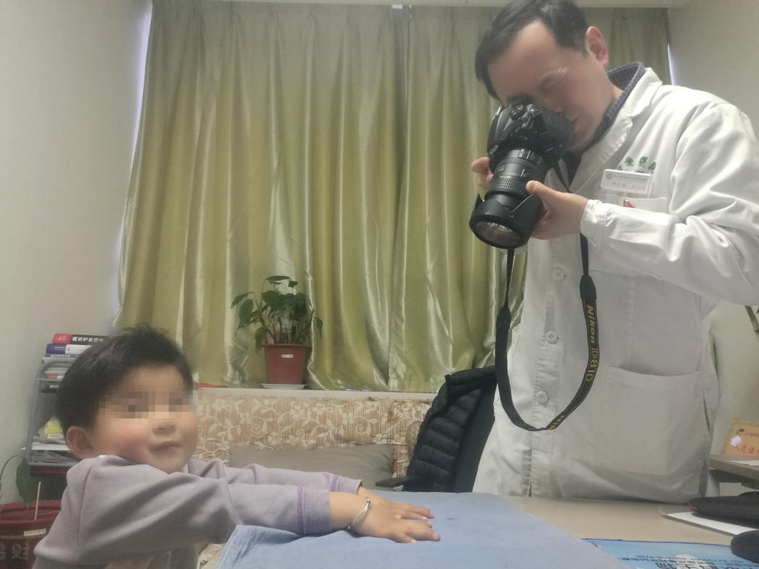 新生儿手指畸形中指食指无名指,婴儿先天性手指畸形中指