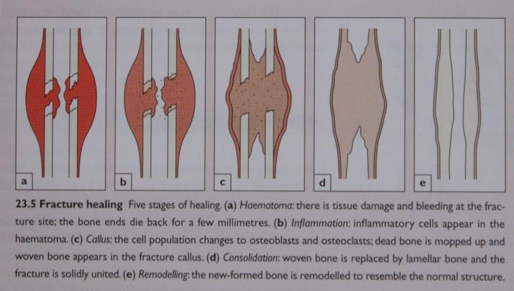 带你了解骨科术后康复,骨科早期康复介入