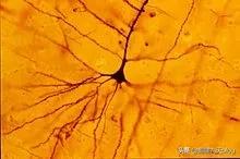 人类大脑如何超越人工智能,人类的出路在于将自身升级为神