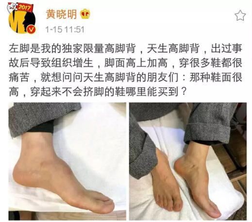 黄晓明穿增高鞋视频,黄晓明内增高现场