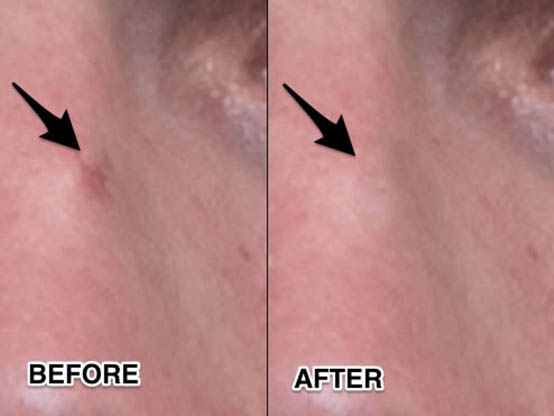 用ps液化,如何用ps把人物液化为漫画