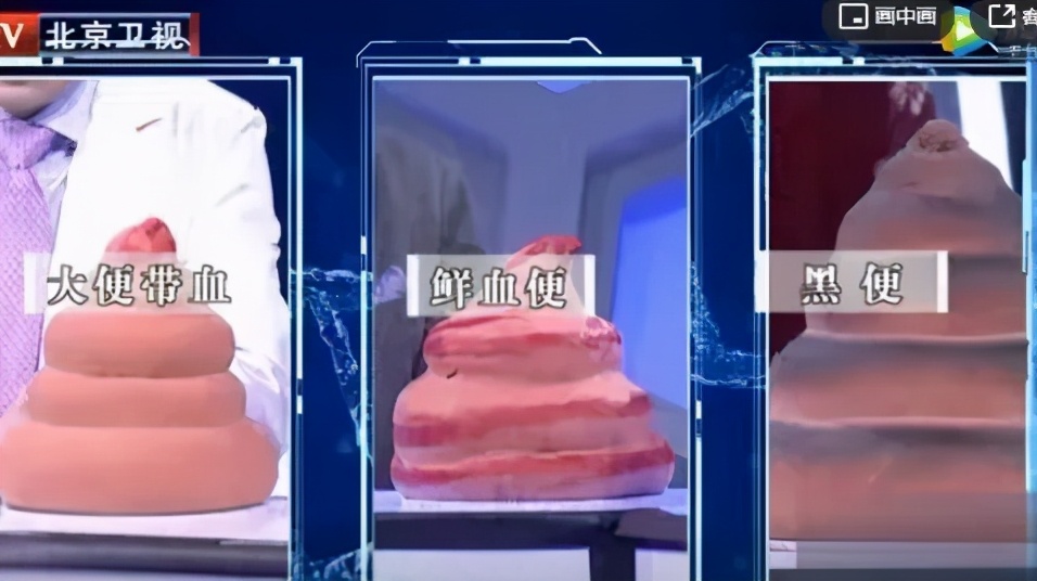 大便拉不干净的解决方法,大便擦不干净是什么原因怎么治疗