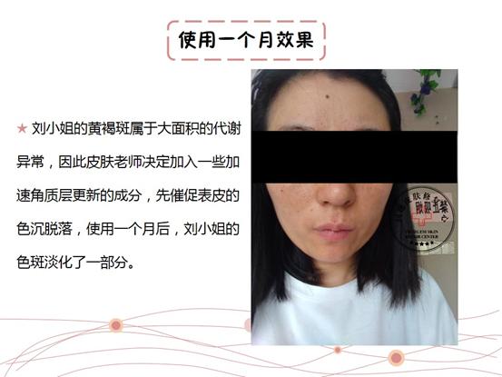 st皮肤修复中心在哪里,妊娠斑修复中心