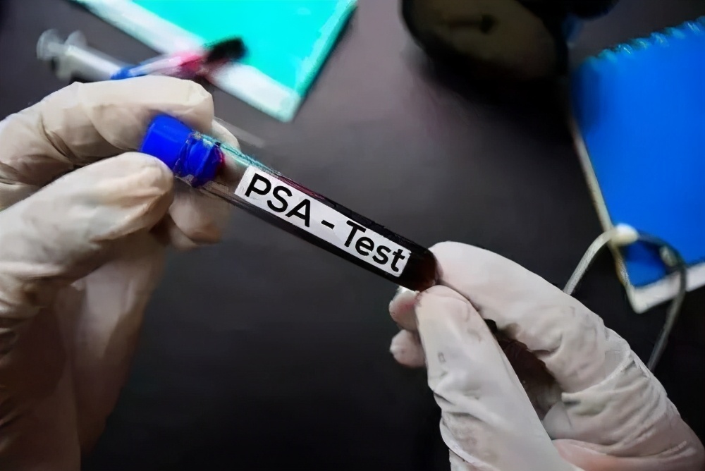 体检哪些项目不值得做,这些体检项目套路深别花冤枉钱