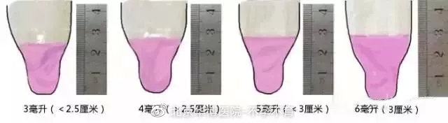 精子质量好坏怎么判断,精子质量好坏怎么判定