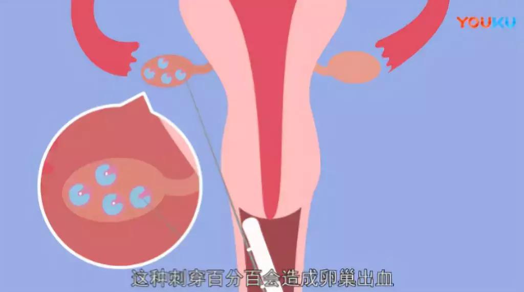 有多少父母把女儿当成了摇钱树,多少父母把爱放在心里
