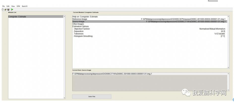 脑功能报告解读,颅脑mri信号讲解视频教程