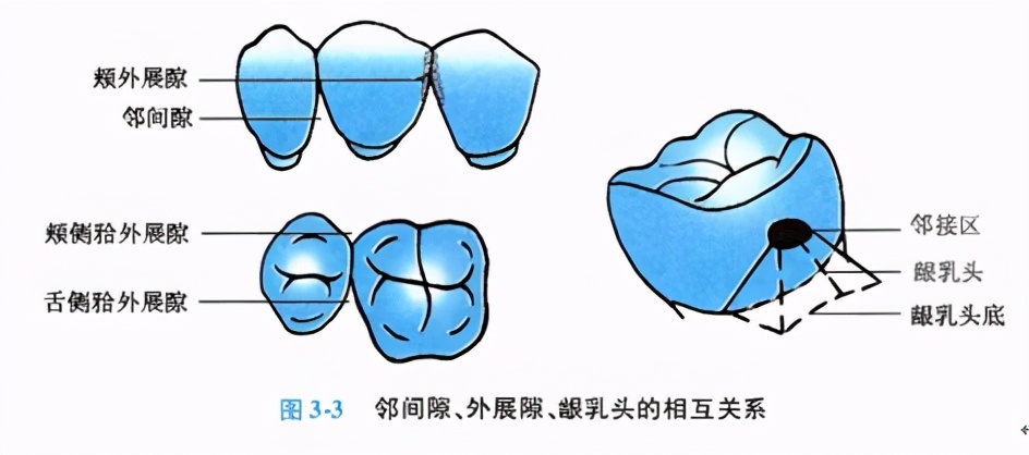 牙齿缺损修复去哪家牙科医院,牙科门牙缺损修复照片