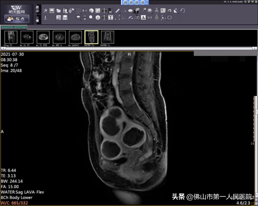 这把“刀”能隔山打“牛”,呵护子宫,带来好“孕”