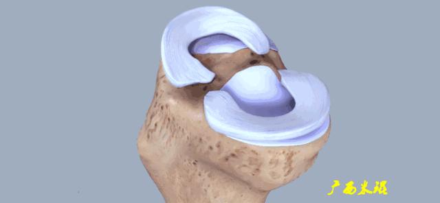 有关半月板的疾病与治疗,听骨科医生讲的话