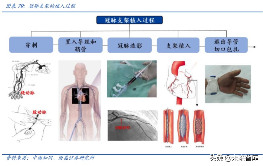 乐普医疗心血管专科医院,乐普医疗的战略