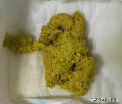 宝宝拉绿便不怎么长肉喝什么奶粉,宝宝拉绿色便便是妈妈吃凉的了吗