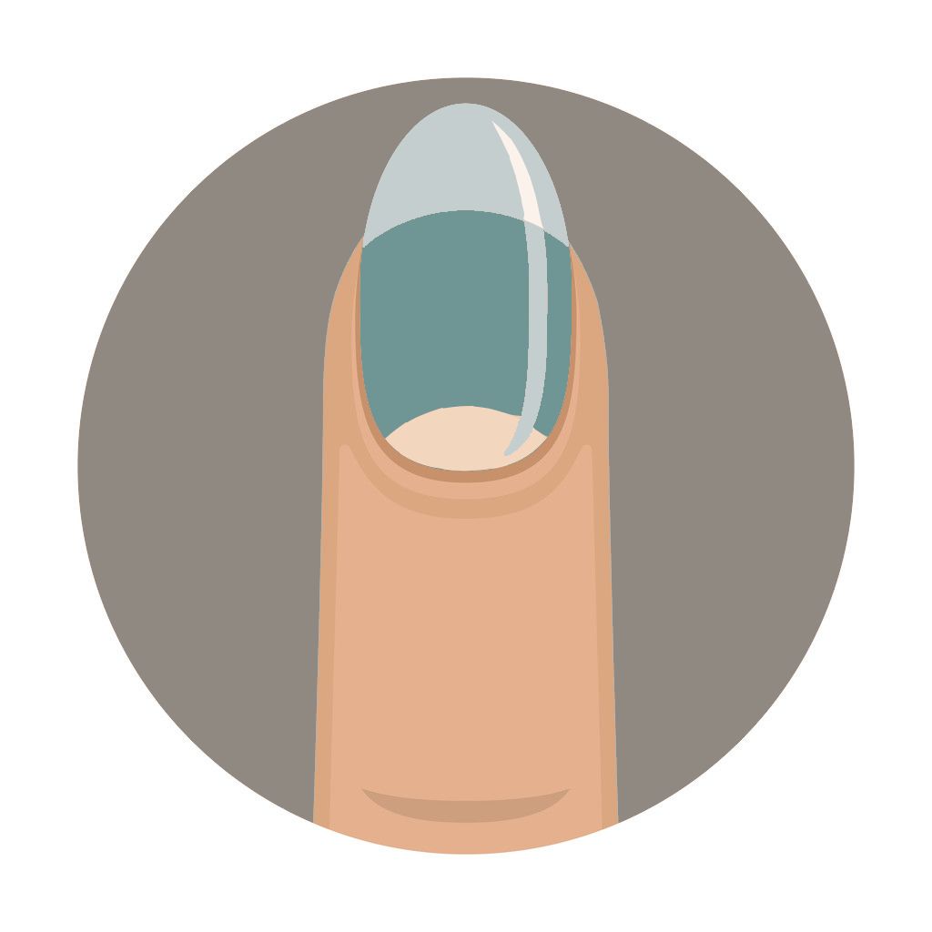 从医学角度，解读手相的秘密