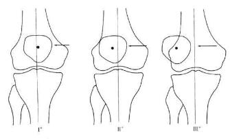 狗狗三角跳怎么回事,狗狗三角跳怎么按摩