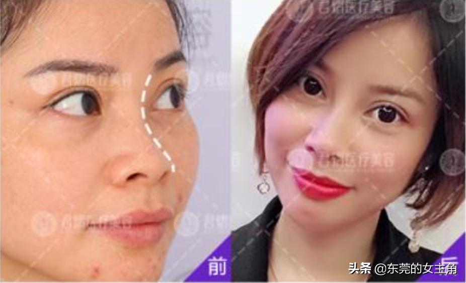 五官之王是什么,五官之王