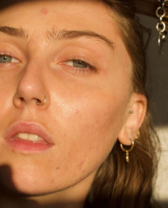 濂崇敓鐖嗙棙蹇呬拱娓呭崟鑽啅,鐖嗙棙浜у搧蹇呬拱娓呭崟