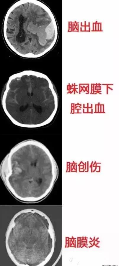 面神经分布图片大全,怎么记住面神经分布