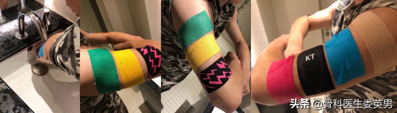 李宁牌肌效贴,李宁肌内效贴儿童