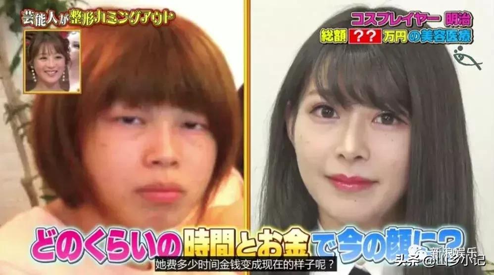 明明是整容脸现在却成了颜值巅峰,明明是整容脸却没被吐槽过