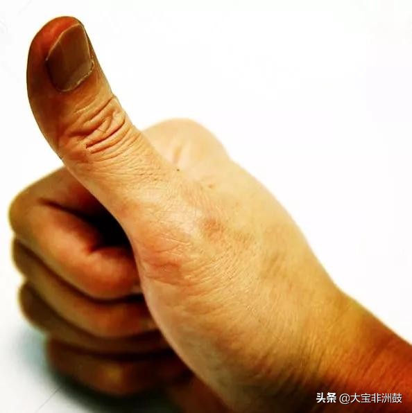 打非洲鼓手疼的几点分析玩非洲鼓手疼之原因