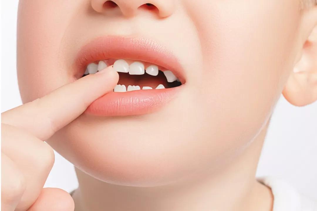 5岁男孩鼻炎鼻塞反复发作怎么办,小孩反复流鼻涕鼻塞是鼻炎吗