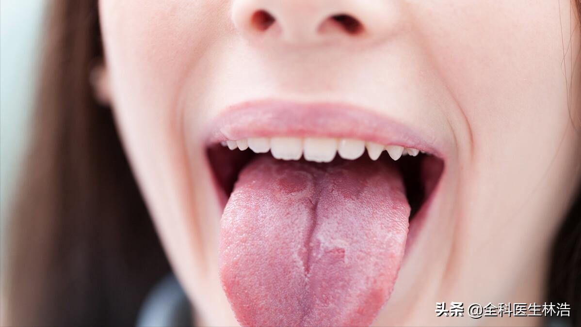 舌头各种异常是什么原因引起的,舌头有齿痕是调理脾胃还是先祛湿