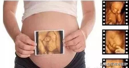 为什么要做胎儿心脏检查,三维正常还要做胎儿心脏超声吗