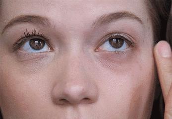 关晓彤有没有黑眼圈,关晓彤黑眼圈困扰