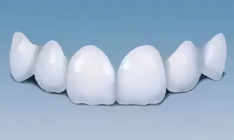 雅悦齿科口碑怎么样,上海雅悦齿科价目表