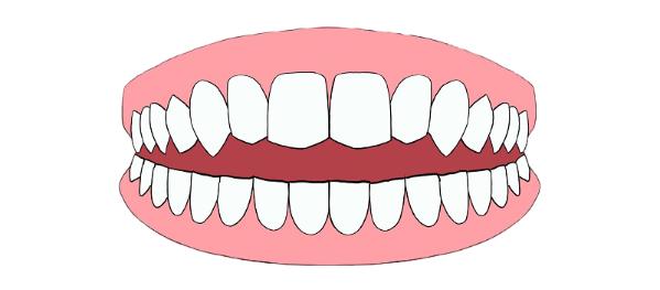 带你了解超详细的牙齿矫正过程,牙齿矫正全过程看完你就知道