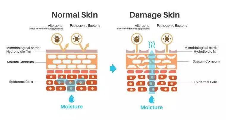 去角质*法大**到底适不适合你?
