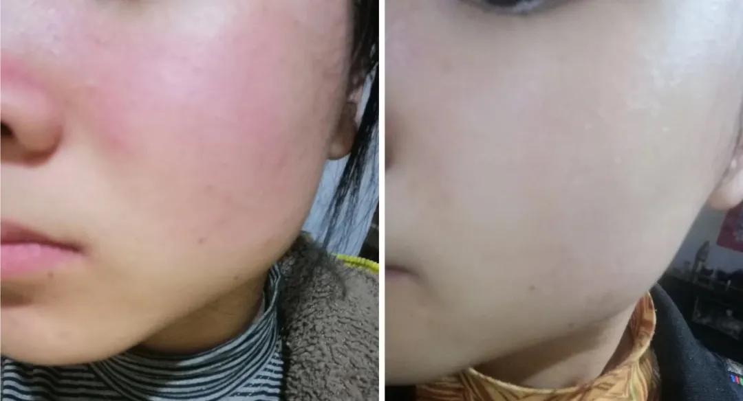 「好评反馈来啦」疯狂打call，实力表白｜为什么*干粉冻**这么受欢迎