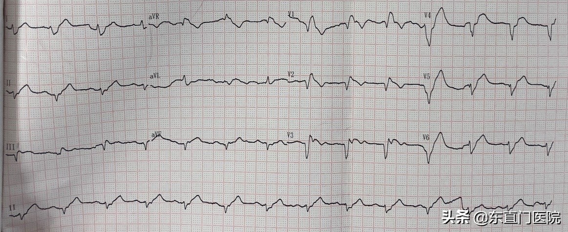 精确规范力挽狂澜