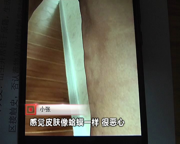 女子花费一万五千元抽脂,女子花三万抽脂术后效果引争议