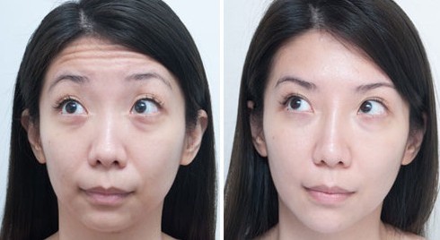 赵露思推荐好物清洁面部,赵露思推荐脸部小熨斗