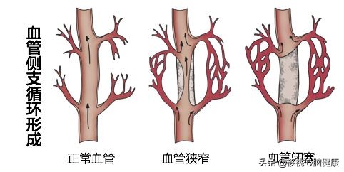 脑里嗡嗡声用什么药好,脑嗡嗡的声音