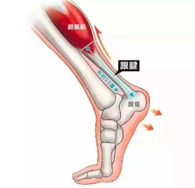 足后跟底踩下去痛是什么原因,早上起床足后跟痛是什么原因