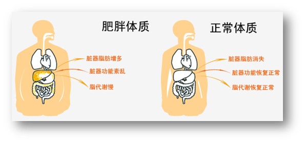 中医如何辨证肥胖,中医减肥怎样判断肥胖类型